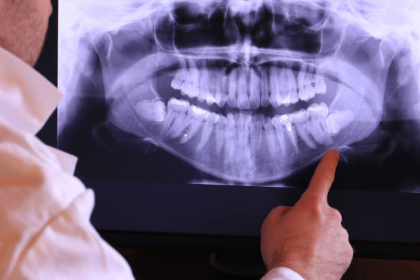 Best Emergency Tooth Extraction in Longview, TX