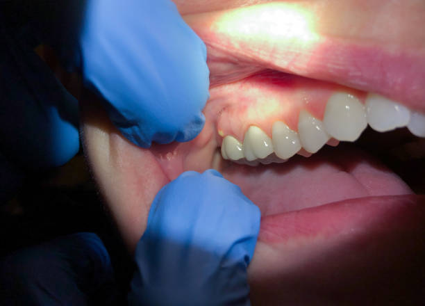 Best Walk-In Emergency Dentist in Longview, TX