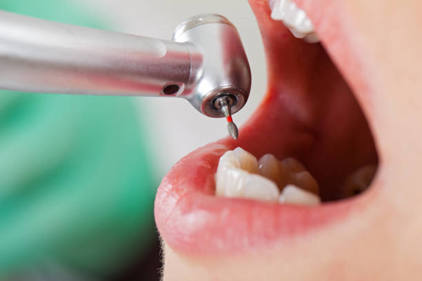 Best Emergency Treatment for Toothache in Longview, TX